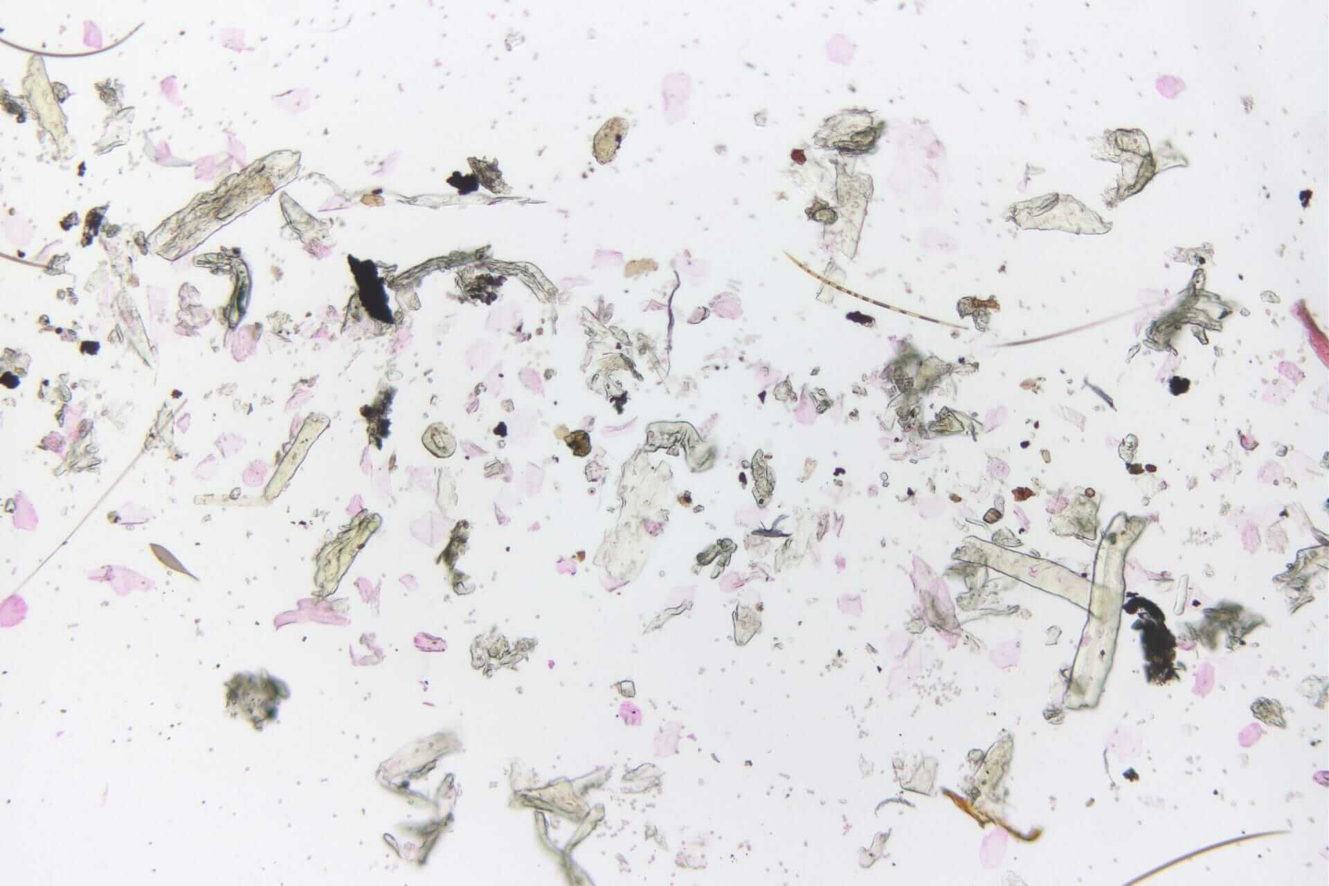 A white surface with pink and black splatters, perfect for mould testing.