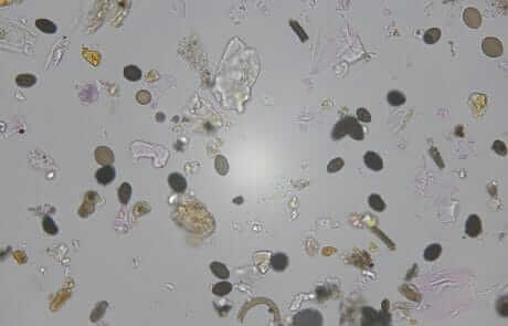 Particle Analysis-Mould Spores & Skin Cell fragments