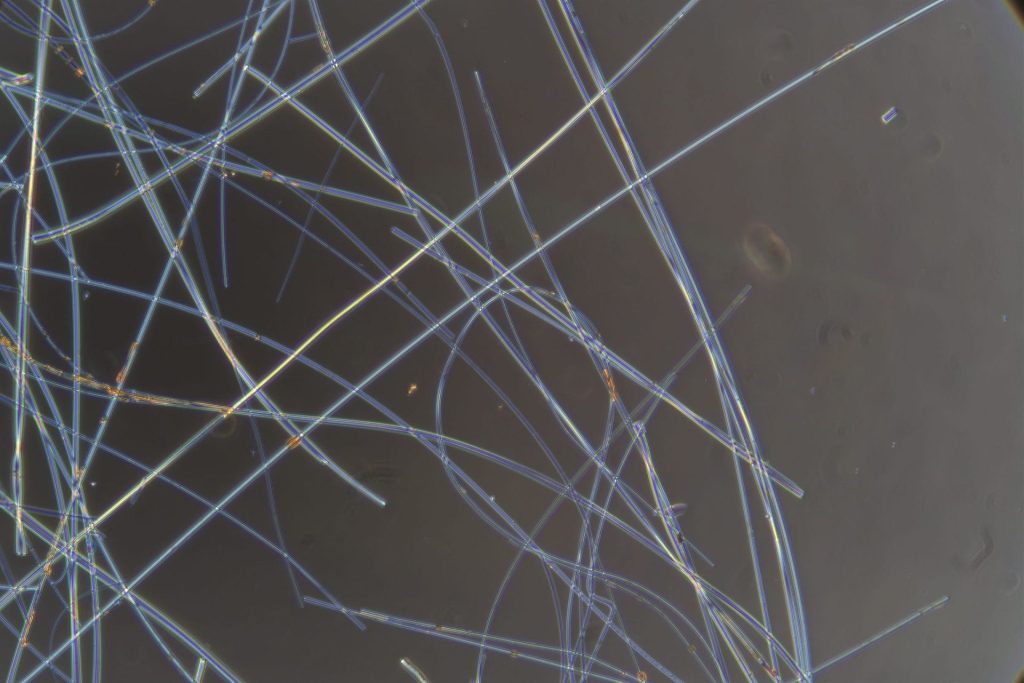 Asbestos Testing Micrograph