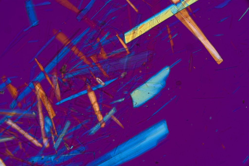 Asbestos Testing Micrograph